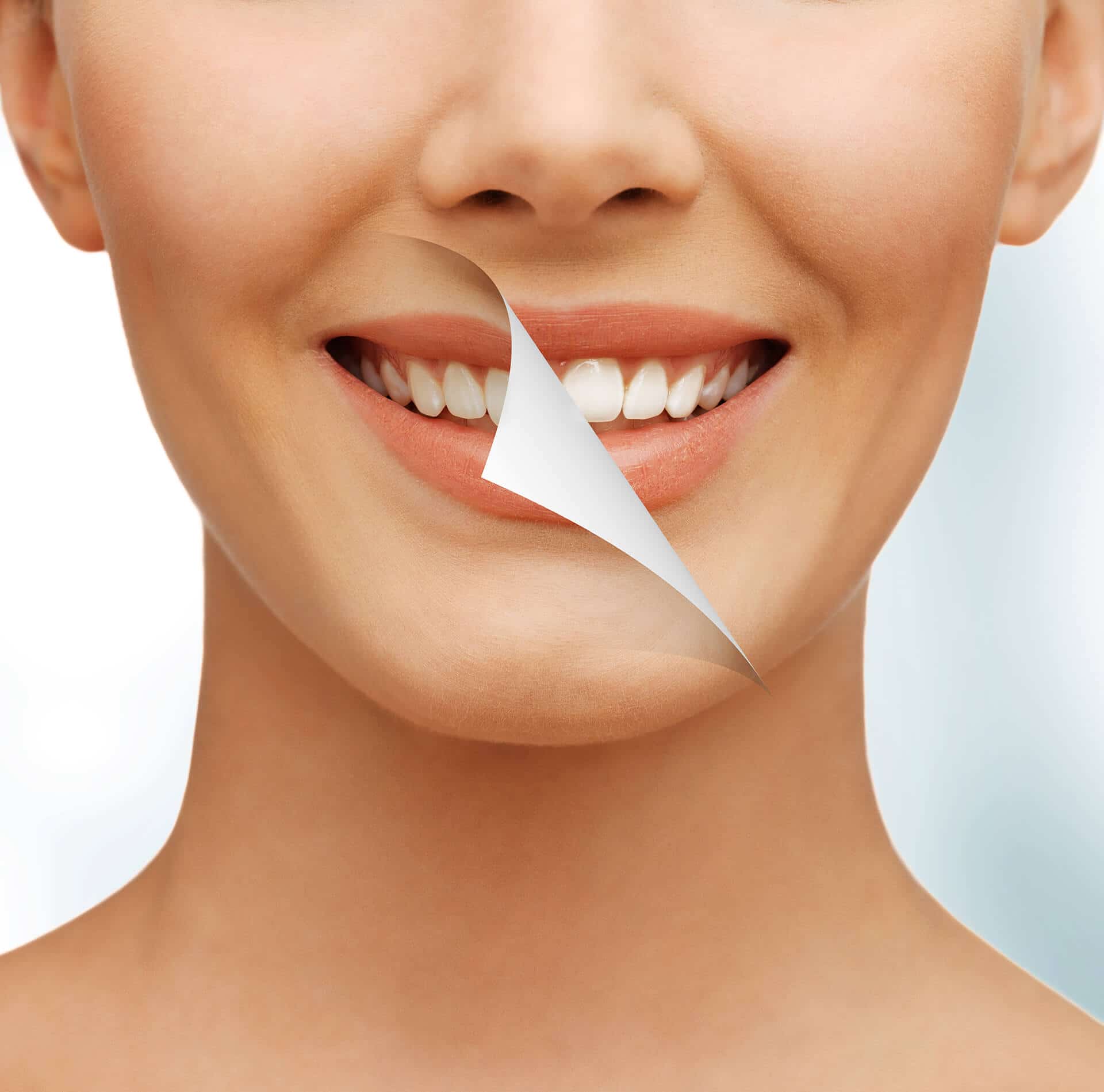 Full Mouth Reconstruction - a woman with perfect teeth Full Mouth Reconstruction - a woman with perfect teeth