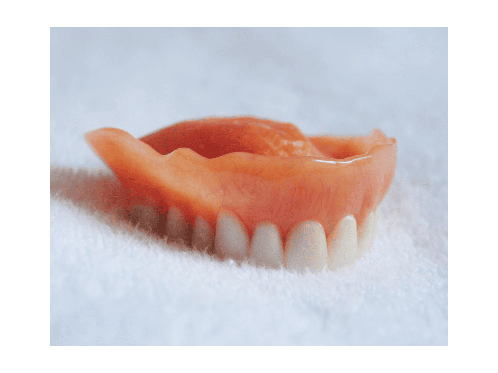 Dentures - upper dentures Dentures - upper dentures