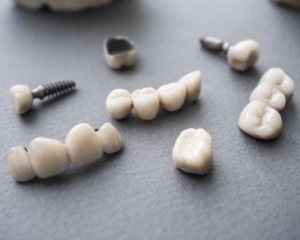 Ceramic-dentures-and-crowns-on-2 Ceramic-dentures-and-crowns-on-2