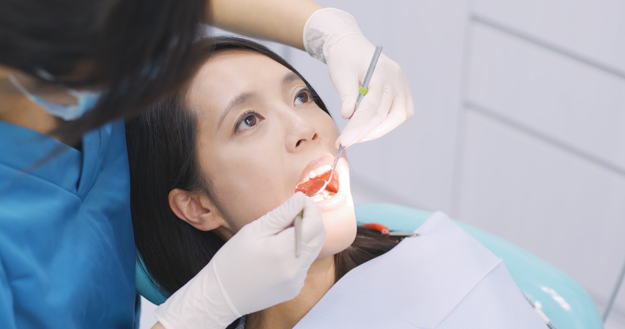 Dentist examining a patient teeth in the dentist - 5 wise facts about wisdom teeth