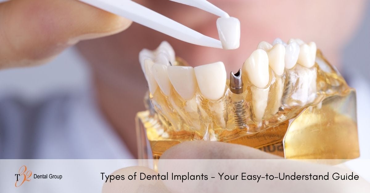 Types of Dental Implants