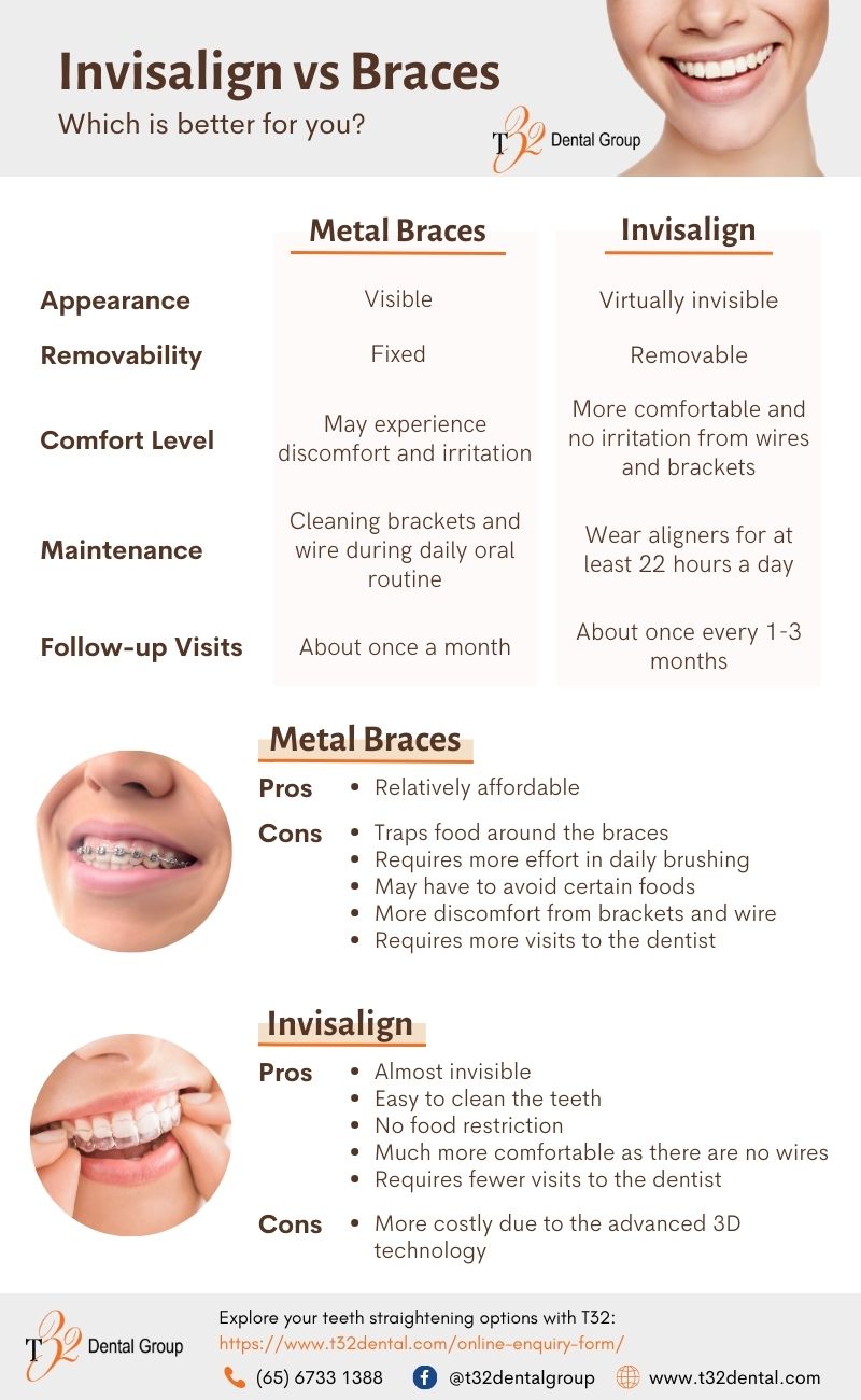 Invisalign Clear Aligners VS Traditional Metal Braces
