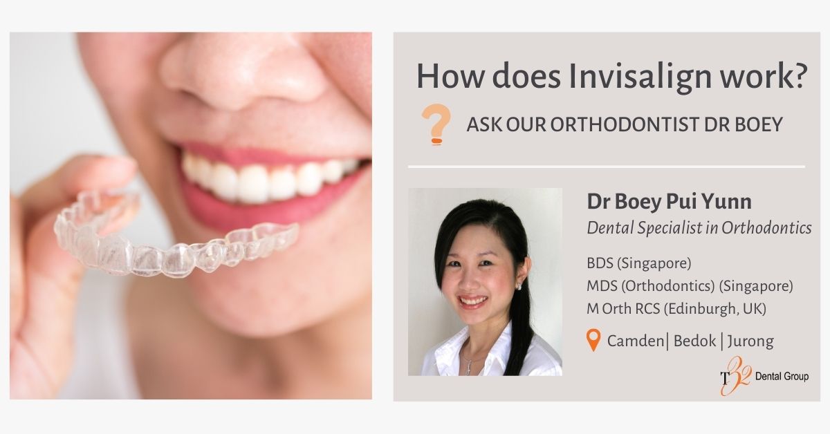 How does Invisalign work Ask Orthodontist Dr Boey